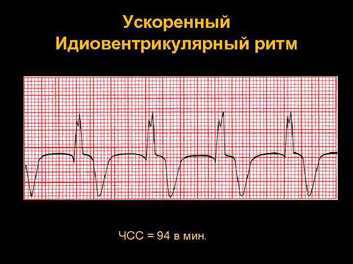 Схема электробаяна ритм