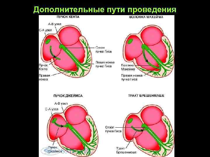 Сердечный путь. Дополнительные пути проведения в сердце. Дополнительные пучки проведения в сердце.