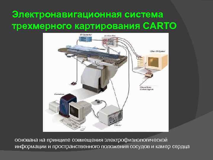 Электронавигационная система трехмерного картирования CARTO основана на принципе совмещения электрофизиологической информации и пространственного положения