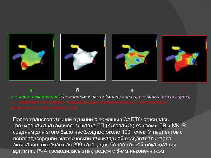 а б в г а – карта активации; б – анатомическая (серая) карта; в