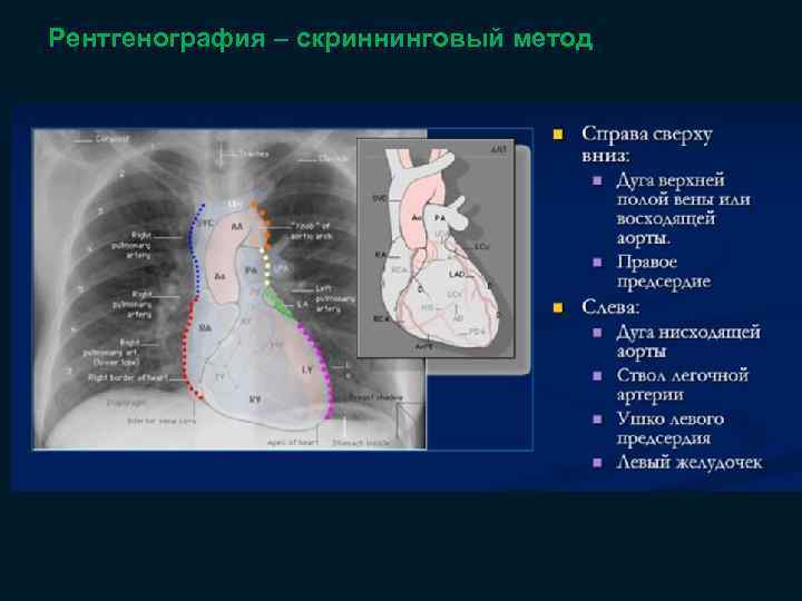 Рентгенография – скриннинговый метод 