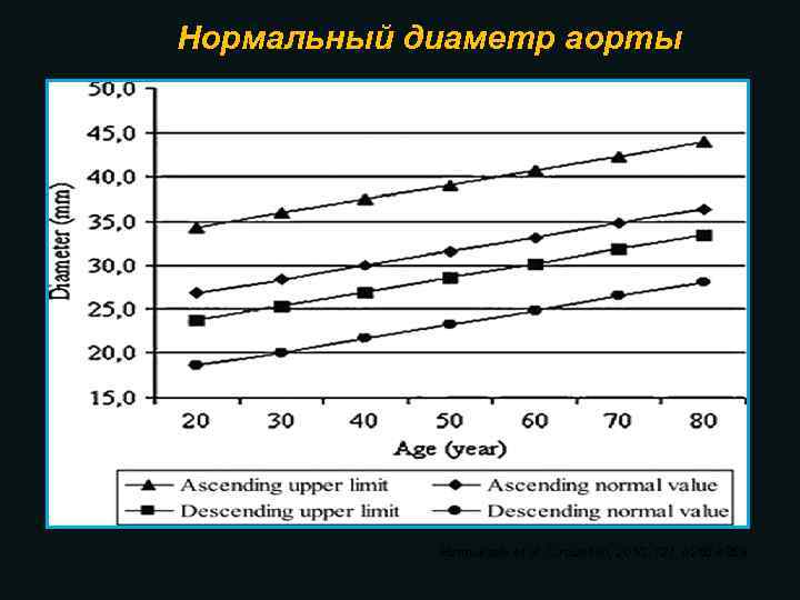 Нормальный диаметр аорты Hannuksela et al. Circulation, 2010, 121: e 266 -e 369 