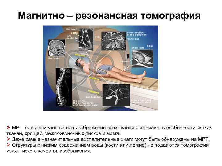 Магнитно – резонансная томография Ø МРТ обеспечивает точное изображение всех тканей организма, в особенности