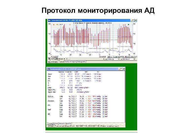 Протокол мониторирования АД 