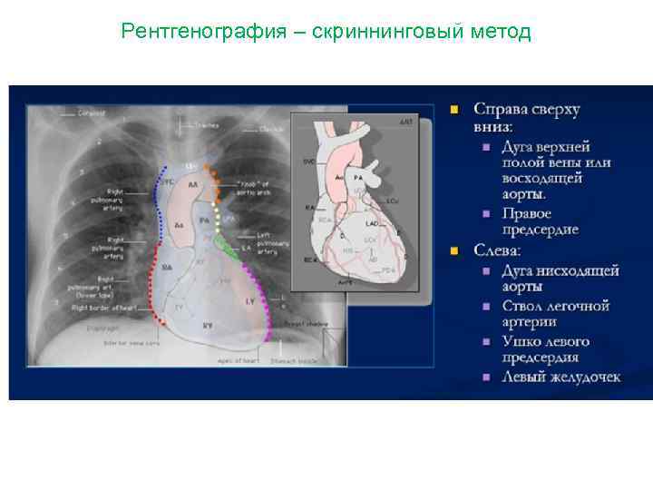 Рентгенография – скриннинговый метод 