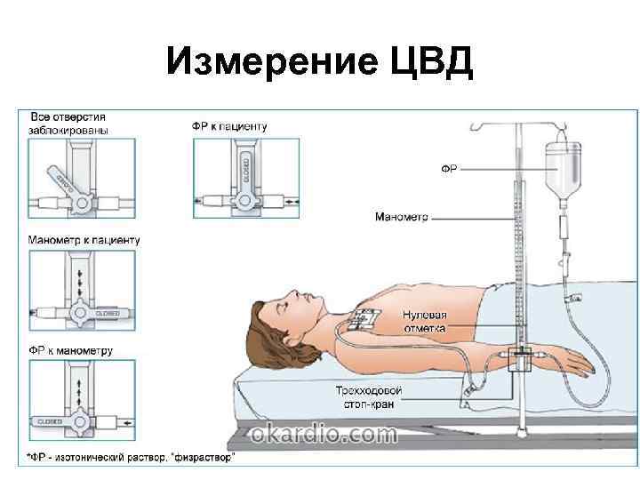 Измерение ЦВД 