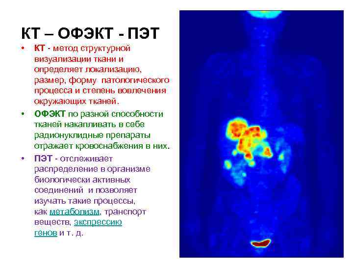 КТ – ОФЭКТ - ПЭТ • • • КТ - метод структурной визуализации ткани