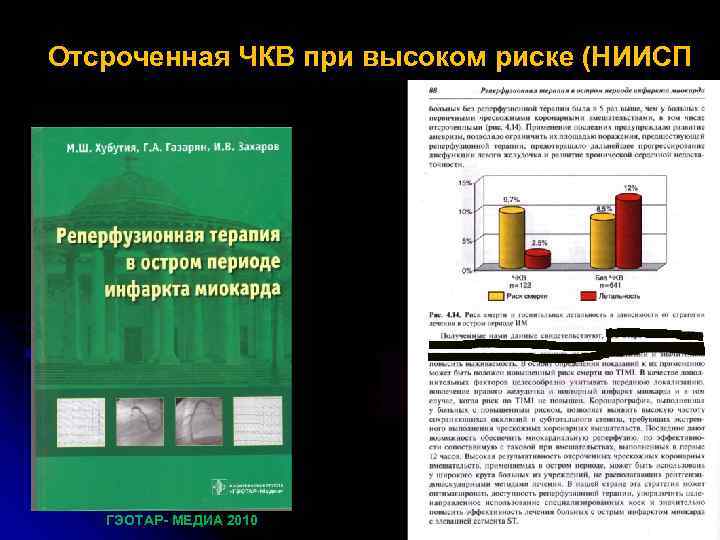 Отсроченная ЧКВ при высоком риске (НИИСП ГЭОТАР- МЕДИА 2010 