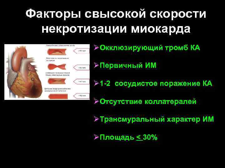 Факторы свысокой скорости некротизации миокарда ØОкклюзирующий тромб КА ØПервичный ИМ Ø 1 -2 сосудистое