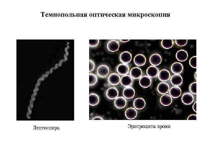 Темнопольная оптическая микроскопия Лептоспира Эритроциты крови 