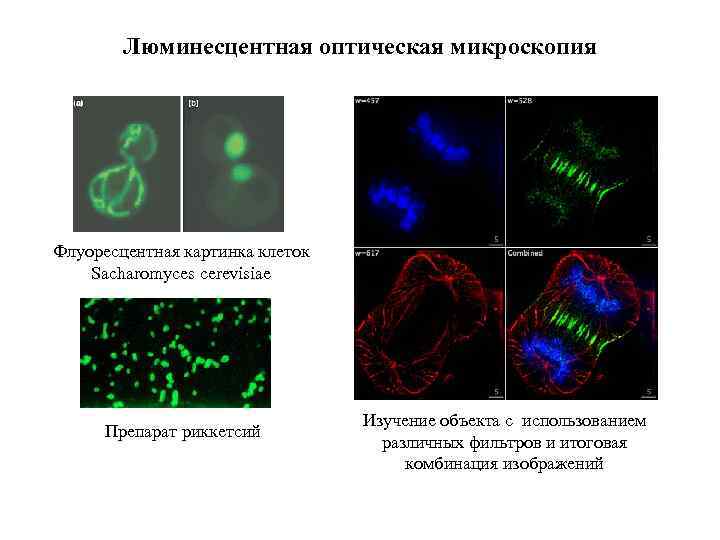 Люминесцентная оптическая микроскопия Флуоресцентная картинка клеток Sacharomyces cerevisiae Препарат риккетсий Изучение объекта с использованием