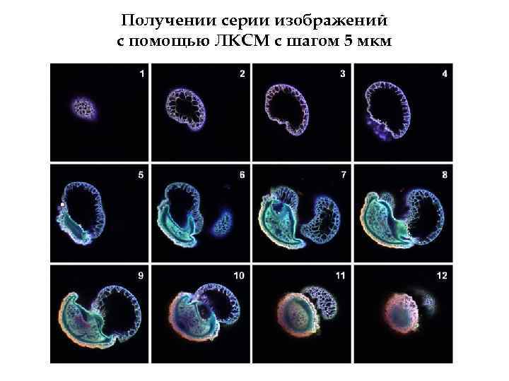 Получении серии изображений с помощью ЛКСМ с шагом 5 мкм 