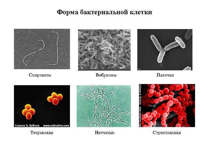 Форма бактериальной клетки Спирохеты Вибрионы Тетракокки Нитчатые Палочки Стрептококки 