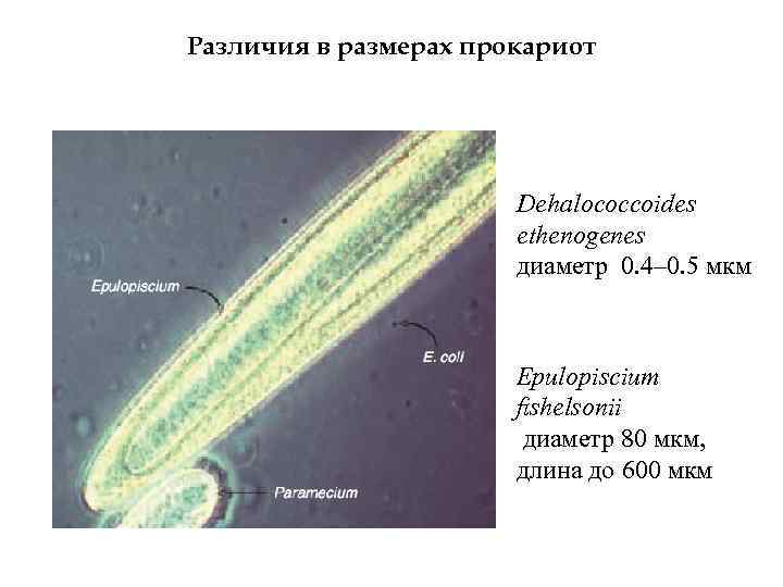 Различия в размерах прокариот Dehalococcoides ethenogenes диаметр 0. 4– 0. 5 мкм Epulopiscium ﬁshelsonii