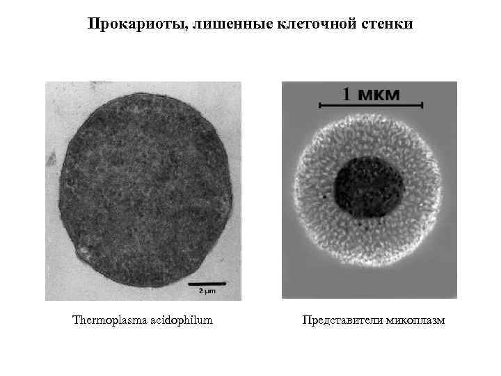 Прокариоты, лишенные клеточной стенки Thermoplasma acidophilum Представители микоплазм 