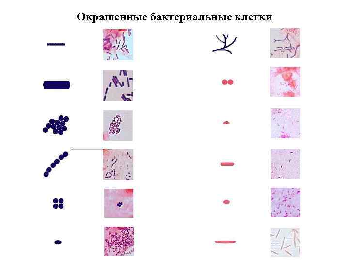 Окрашенные бактериальные клетки 