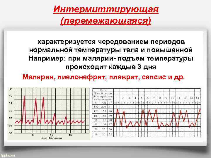 Интермиттирующая (перемежающаяся) характеризуется чередованием периодов нормальной температуры тела и повышенной Например: при малярии- подъем