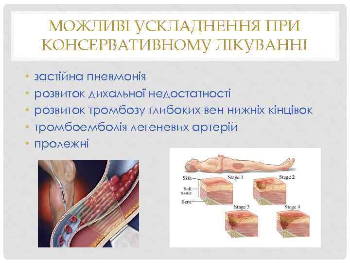 МОЖЛИВІ УСКЛАДНЕННЯ ПРИ КОНСЕРВАТИВНОМУ ЛІКУВАННІ • • • застійна пневмонія розвиток дихальної недостатності розвиток