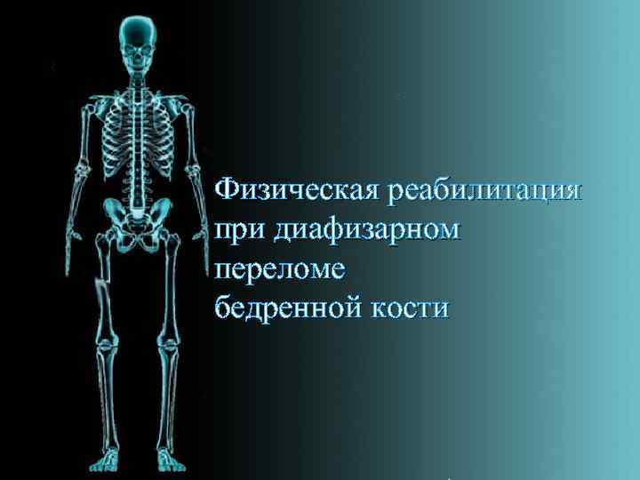 Физическая реабилитация при диафизарном переломе бедренной кости 