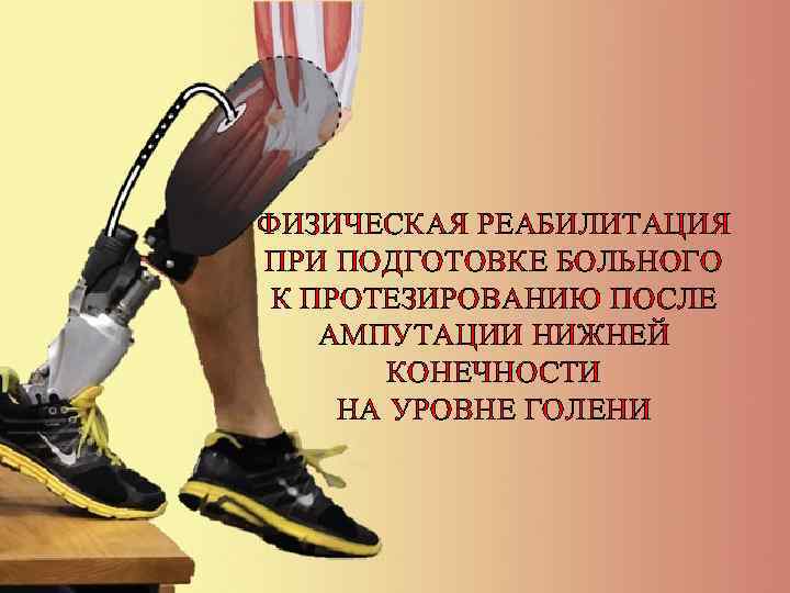 ФИЗИЧЕСКАЯ РЕАБИЛИТАЦИЯ ПРИ ПОДГОТОВКЕ БОЛЬНОГО К ПРОТЕЗИРОВАНИЮ ПОСЛЕ АМПУТАЦИИ НИЖНЕЙ КОНЕЧНОСТИ НА УРОВНЕ ГОЛЕНИ