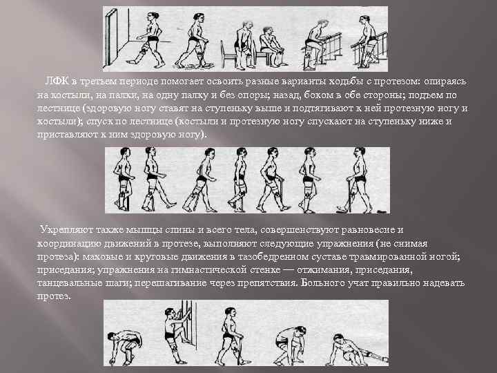 ЛФК в третьем периоде помогает освоить разные варианты ходьбы с протезом: опираясь на костыли,