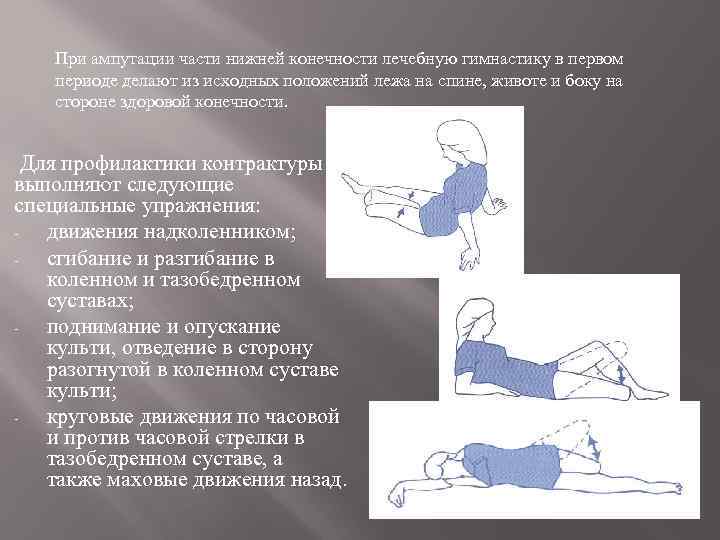 При ампутации части нижней конечности лечебную гимнастику в первом периоде делают из исходных положений