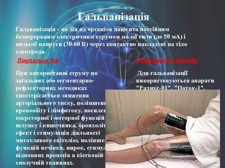 Гальванізація - ця дія на організм пацієнта постійним безперервним електричним струмом малої сили (до