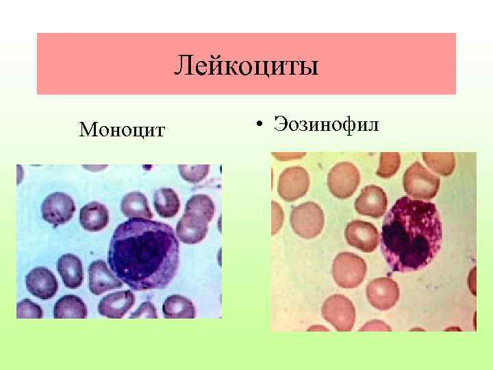 Лейкоциты Моноцит • Эозинофил 