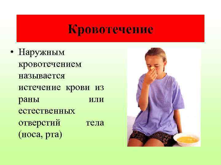 Кровотечение • Наружным кровотечением называется истечение крови из раны или естественных отверстий тела (носа,