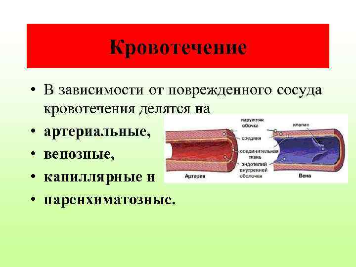 Кровотечение • В зависимости от поврежденного сосуда кровотечения делятся на • артериальные, • венозные,