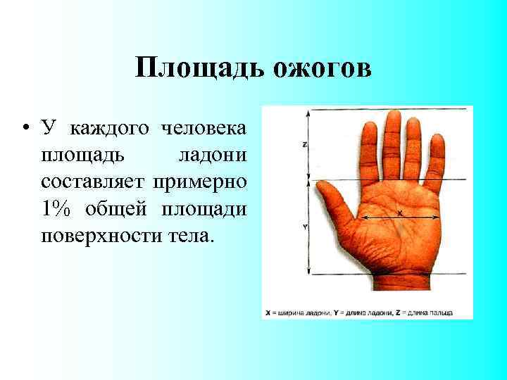 Площадь ожогов • У каждого человека площадь ладони составляет примерно 1% общей площади поверхности