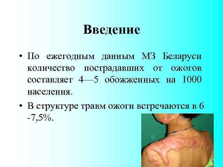 Введение • По ежегодным данным МЗ Беларуси количество пострадавших от ожогов составляет 4— 5