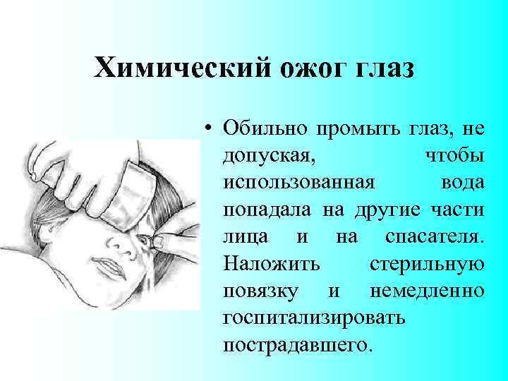 Химический ожог глаз • Обильно промыть глаз, не допуская, чтобы использованная вода попадала на