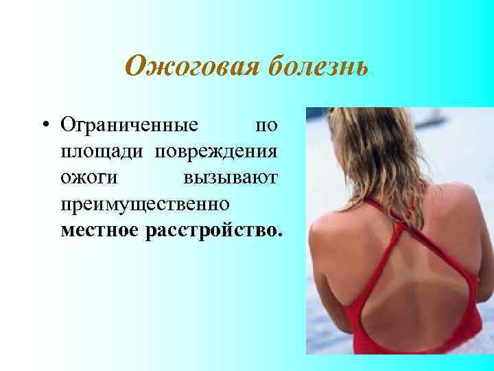 Ожоговая болезнь • Ограниченные по площади повреждения ожоги вызывают преимущественно местное расстройство. 