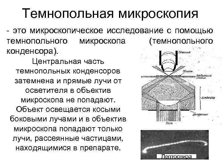 Темнопольная микроскопия - это микроскопическое исследование с помощью темнопольного микроскопа (темнопольного конденсора). Центральная часть