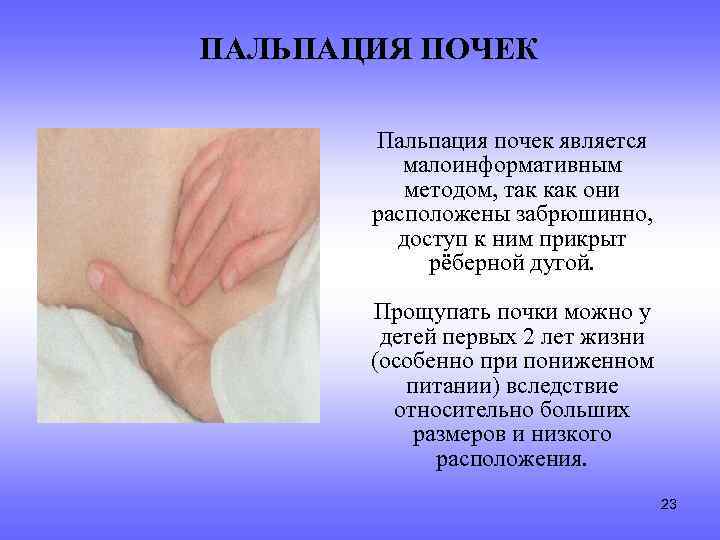 ПАЛЬПАЦИЯ ПОЧЕК Пальпация почек является малоинформативным методом, так как они расположены забрюшинно, доступ к