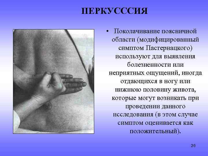 ПЕРКУСССИЯ • Поколачивание поясничной области (модифицированный симптом Пастернацкого) используют для выявления болезненности или неприятных