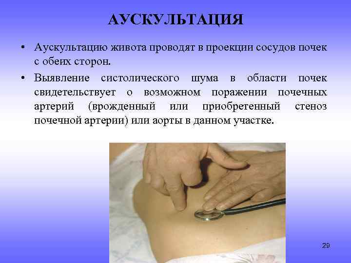 АУСКУЛЬТАЦИЯ • Аускультацию живота проводят в проекции сосудов почек с обеих сторон. • Выявление