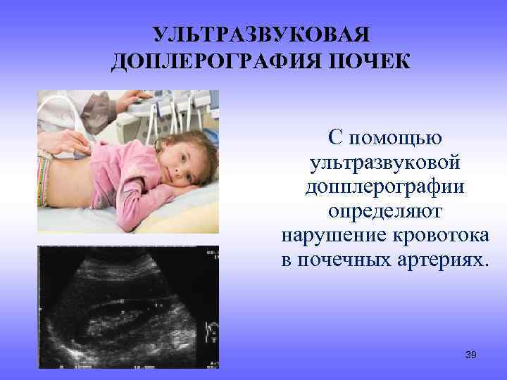 УЛЬТРАЗВУКОВАЯ ДОПЛЕРОГРАФИЯ ПОЧЕК С помощью ультразвуковой допплерографии определяют нарушение кровотока в почечных артериях. 39