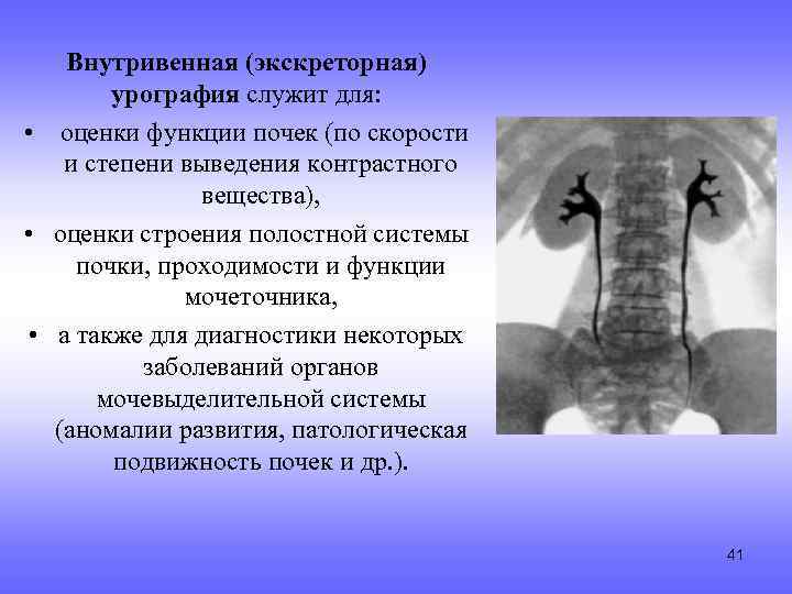 Внутривенная (экскреторная) урография служит для: • оценки функции почек (по скорости и степени выведения