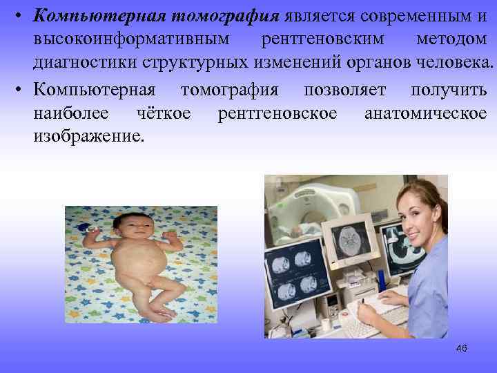  • Компьютерная томография является современным и высокоинформативным рентгеновским методом диагностики структурных изменений органов