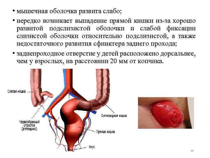  • мышечная оболочка развита слабо; • нередко возникает выпадение прямой кишки из-за хорошо