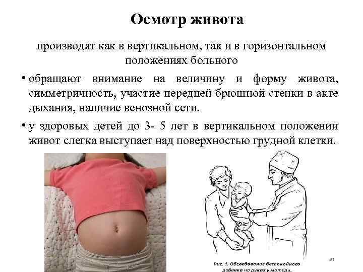 Осмотр живота производят как в вертикальном, так и в горизонтальном положениях больного • обращают