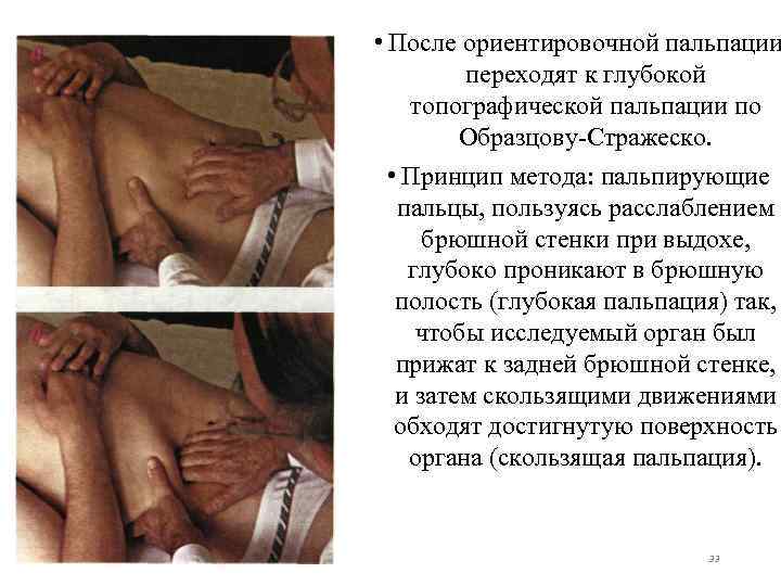  • После ориентировочной пальпации переходят к глубокой топографической пальпации по Образцову-Стражеско. • Принцип