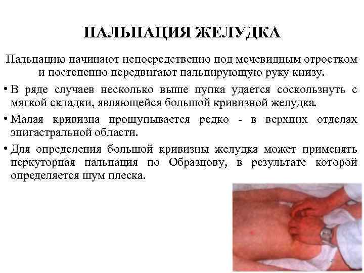 ПАЛЬПАЦИЯ ЖЕЛУДКА Пальпацию начинают непосредственно под мечевидным отростком и постепенно передвигают пальпирующую руку книзу.