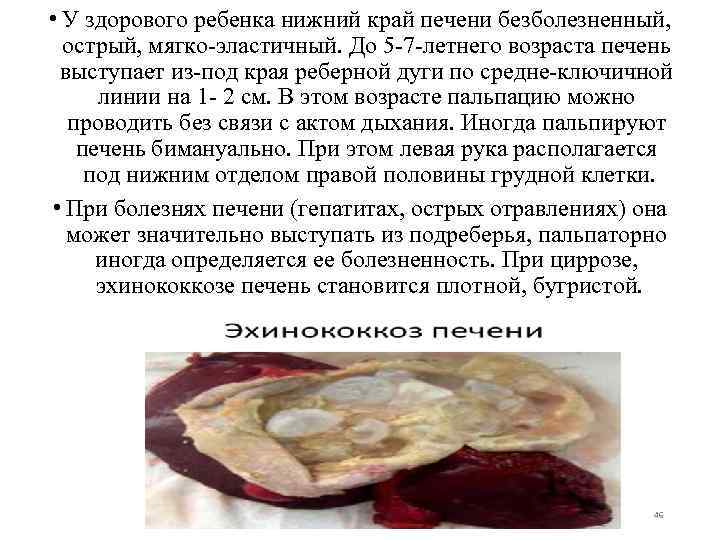  • У здорового ребенка нижний край печени безболезненный, острый, мягко-эластичный. До 5 -7