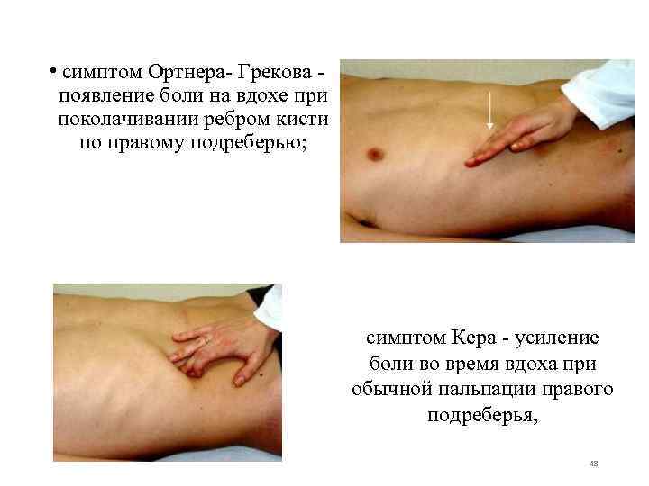  • симптом Ортнера- Грекова - появление боли на вдохе при поколачивании ребром кисти