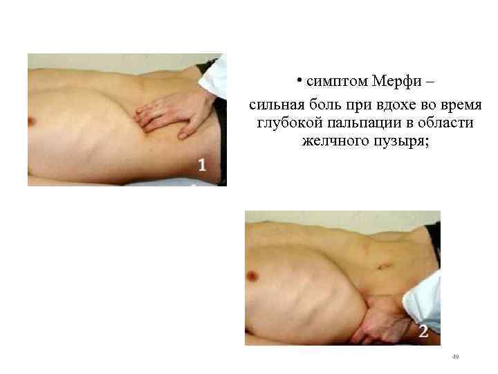  • симптом Мерфи – сильная боль при вдохе во время глубокой пальпации в