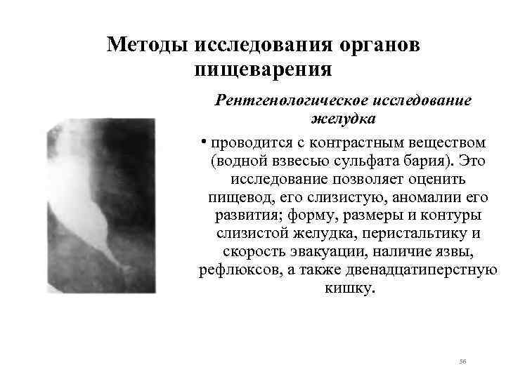 Методы исследования органов пищеварения Рентгенологическое исследование желудка • проводится с контрастным веществом (водной взвесью