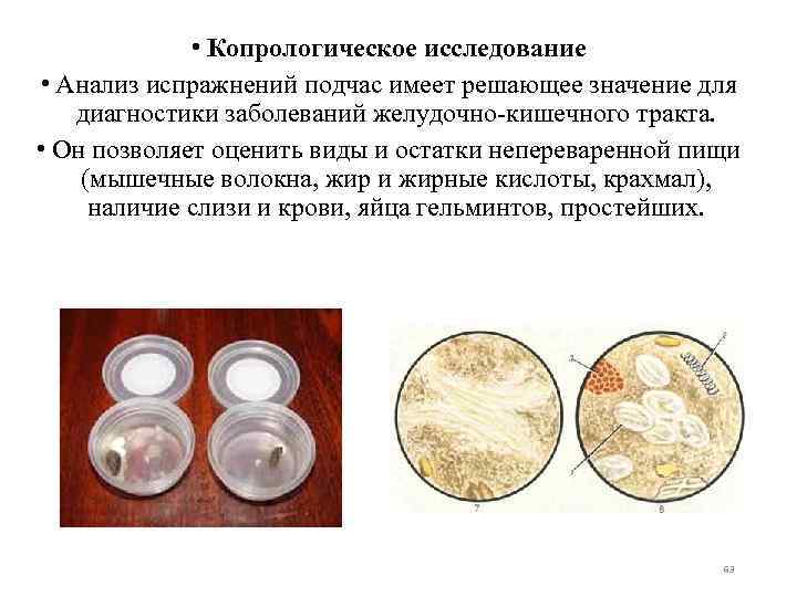  • Копрологическое исследование • Анализ испражнений подчас имеет решающее значение для диагностики заболеваний